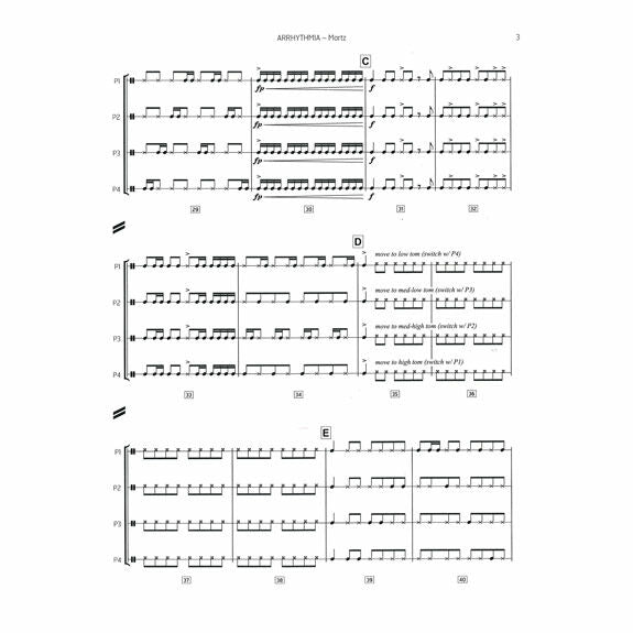 Martz-Arrhythmia (SP)-P
